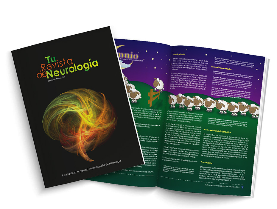 Tu-Revista-de-Neurologia